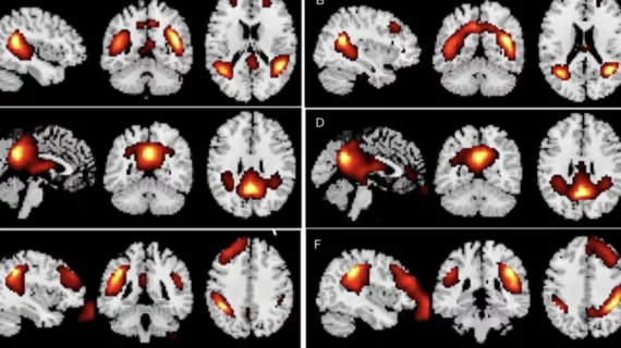 Prompt engineering experts' brains are wired differently