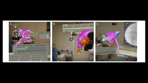 Sentiar CommandEP mixed reality system virtual screens augmented reality.