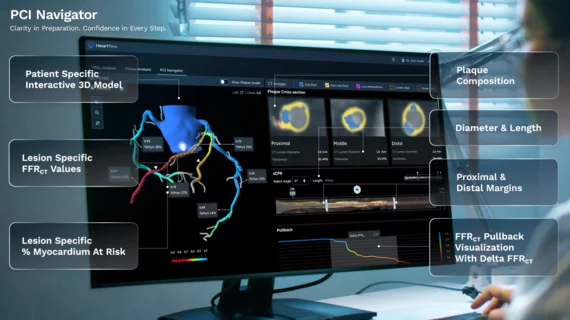 Heartflow PCI Navigator Cardiology