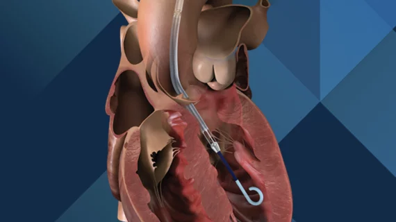 Impella CP Johnson & Johnson MedTech Abiomed