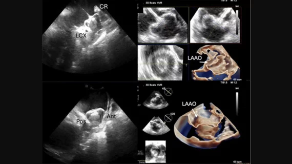SCAI ICE position statement
