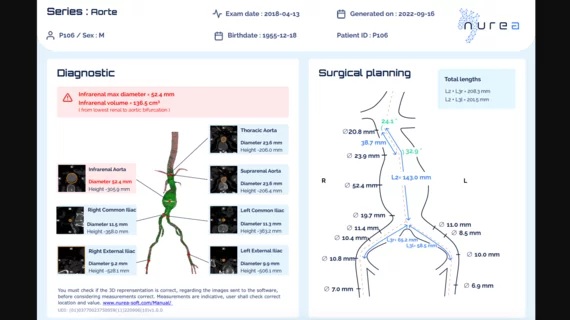Nurea PRAEVAorta 2