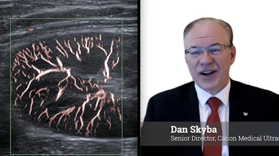 Caon Medical USA ultrasound director Dan Skyba explains advances in ultrasound processing algorithms at RSNA 2025.