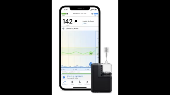 Tandem Mobi Insulin Pump