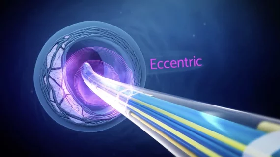The Boston Scientific Seismiq intravascular lithotripsy (IVL) system entered commercial use in the U.S. in January 2026.