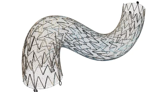 CGuard Prime carotid stent system was cleared by the U.S. Food and Drug Administration (FDA) in June 2025.