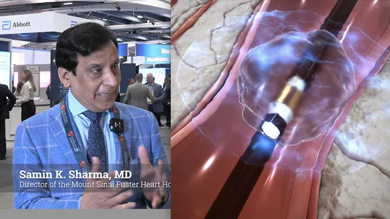 Advances in calcified coronary plaque modification are increasingly centered on intravascular lithotripsy (IVL) because the technology reduces complications such as vessel trauma and perforation associated with traditional high-pressure balloons or atherectomy techniques. Cardiovascular Business spoke with Samin K. Sharma, MD, director of the Mount Sinai Fuster Heart Hospital Cardiovascular Clinical Institute, recently about the advances in IVL. #IVL #TCT
