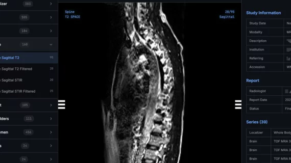 Shopify CEO says he created his own MRI viewer with AI