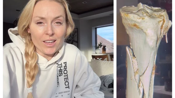 Lindsey Vonn shares images from Olympics injury