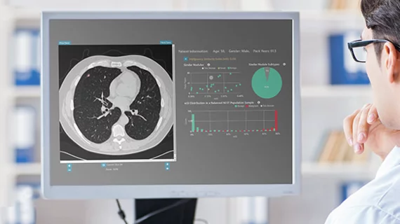 FDA clears algorithm that detects and quantifies incidental lung nodules