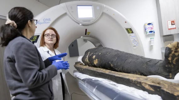 Radiologists reveal new insight into ancient history