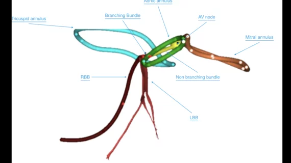 simulation of the conduction pathway relative to various cardiac structures.