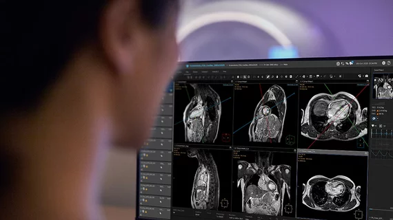 Philips has secured U.S. Food and Drug Administration (FDA) clearance for SmartHeart, the company’s new artificial intelligence (AI)-powered planning technology for cardiac MR (CMR) exams. 