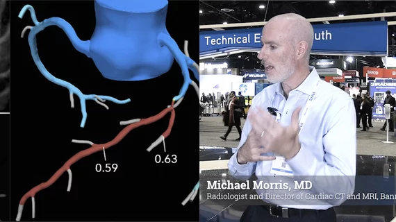 Radiologist Michael Morris, MD, radiologist and director of cardiac CT and MRI at Banner Health, explains how cardiac radiology imaging is moving toward expanded use of fractional flow reserve CT (FFR-CT) and artificial intelligence analysis of coronary CT angiography (CCTA) exams as a standard of care. He spoke to Radiology Business during RSNA 2025.