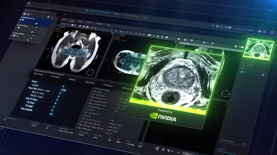 Nvidia Philips MRI