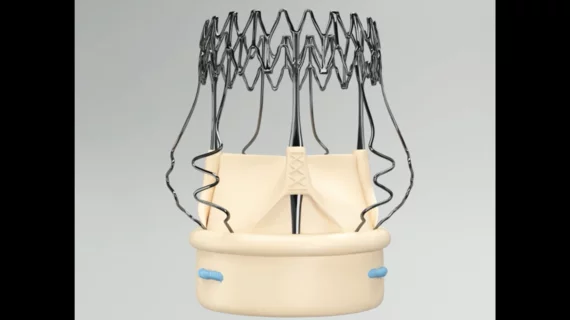 corcym Perceval Plus LANCELOT