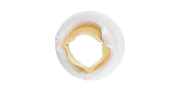 Mosaic mitral bioprosthesis Medtronic