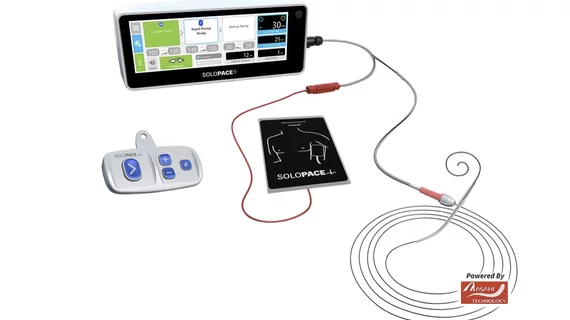 The SoloPace Fusion Temporary Pacing System from Solo Pace Inc. is deigned to eliminate the need for right ventricular (RV) lead placement, which requires the added procedural step to gaining venous access. This can cut procedure time and mitigate possible complication risks. For interventional cardiologists using improvised left ventricular (LV) pacing, this system can replace ad-hoc clip assemblies, subcutaneous needles and exposed wire connections, which are known sources of inconsistent pace capture. 