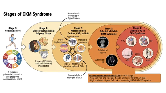 The stages of cardiovascular-kidney-metabolic syndrome that was included in the new ACC-AHA CKM syndrome guideline.