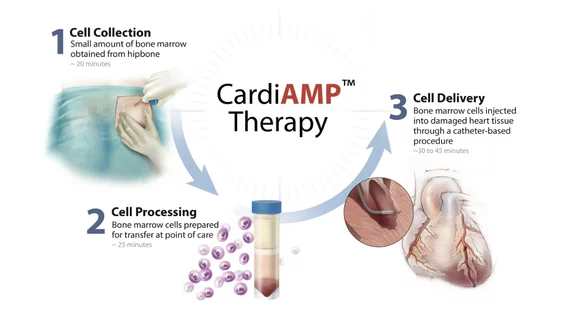 BioCardia's CardioAMP heart failure cell therapy.