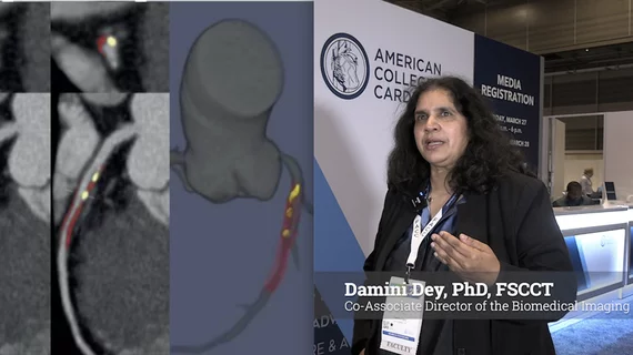 Damini Dey, PhD, FSCCT, a professor of biomedical sciences, co-associate director of the Biomedical Imaging Research Institute, and director of the quantitative image analysis program at Cedars-Sinai, explains how artificial intelligence (AI) is impacting cardiovascular imaging without most people realizing.