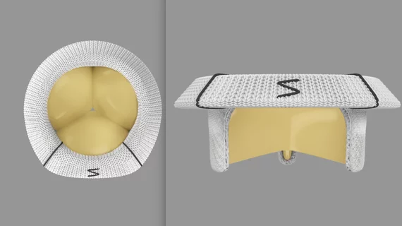 The Edwards Lifesciences Triformis Resilia surgical tricuspid valve top and side views..