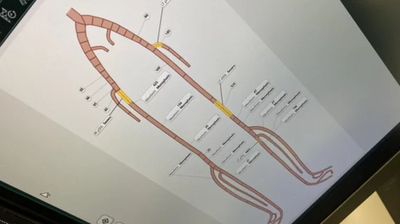 pad peripheral femoral and illiac artery diagram for cvis interventional reporting for fujifilm hims23