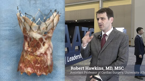 Robert Hawkins, MD, MSC, assistant professor of cardiac surgery, University of Michigan, discusses the growing trends of surgical aortic valve replacement (SAVR) following prior transcatheter aortic valve replacement (TAVR) and how to best risk assess these patients using a new STS risk calculator.
