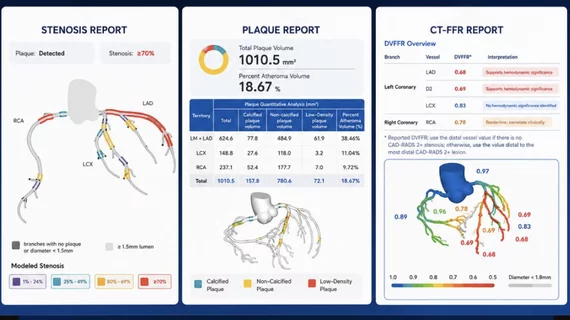 Keya medical's plaque analysis and FFR-CT reports generated from a single CT scan.