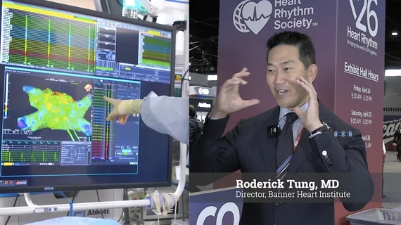 Roderick Tung explains cardio-neuro ablation therapy for recurrent vasovagal syncope