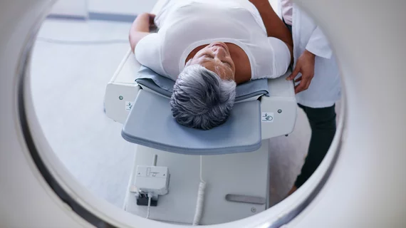 brain alzheimers pet scan drug CT dementia