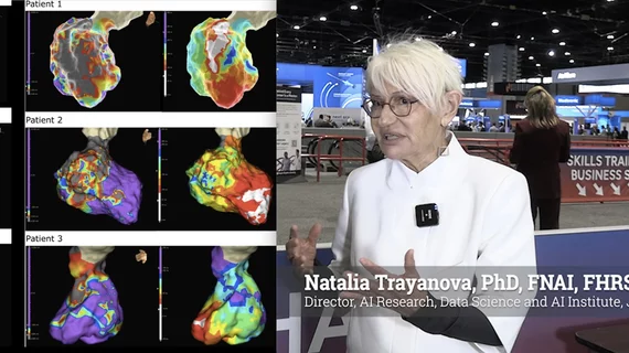 Natalia Trayanova, PhD, FNAI, FHRS, FAHA, FACC, FESC, FEHRA, FIAMBE, FBMES, FAIMBE, FIUPS, FIEEE, Professor of Biomedical Engineering, Director of the Alliance for Cardiovascular Diagnostic and Treatment innovation (ADVANCE), and director of AI research in health and medicine, at the Data Science and AI Institute at Johns Hopkins University, explains how her team has developed a digital twin to copy the electrical function of a specific patient's heart to test various ablation strategies.