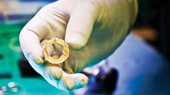 A Medtronic Evolut Corevalve TAVR valve in use at Emory.