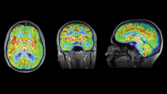 Example_MR-PET.jpg Thumbnail